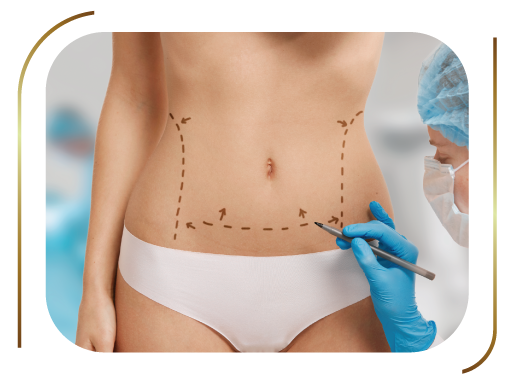 A abdominoplastia é um procedimento que visa remover o excesso de gordura e pele, restaurar os músculos enfraquecidos ou separados e criar um perfil abdominal mais suave e tonificado. Mesmo com exercícios físicos e controle de peso, algumas pessoas não conseguem atingir a aparência desejada. Um abdômen protruso, flácido ou frouxo pode ocorrer devido a fatores como gravidez, envelhecimento, oscilações significativas no peso, hereditariedade ou cirurgias prévias.